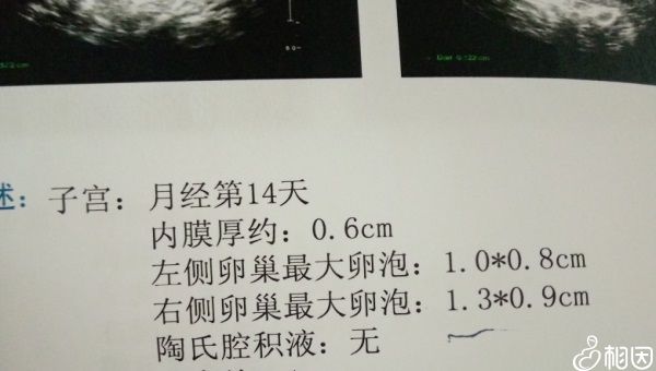 男性在试管手术的准备阶段应该怎么做