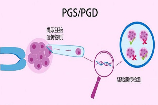 供卵生子哪里可以做价格表到底可信吗